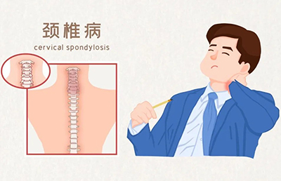 警惕！骨與關(guān)節(jié)的“健康危機(jī)”，你中招了嗎？